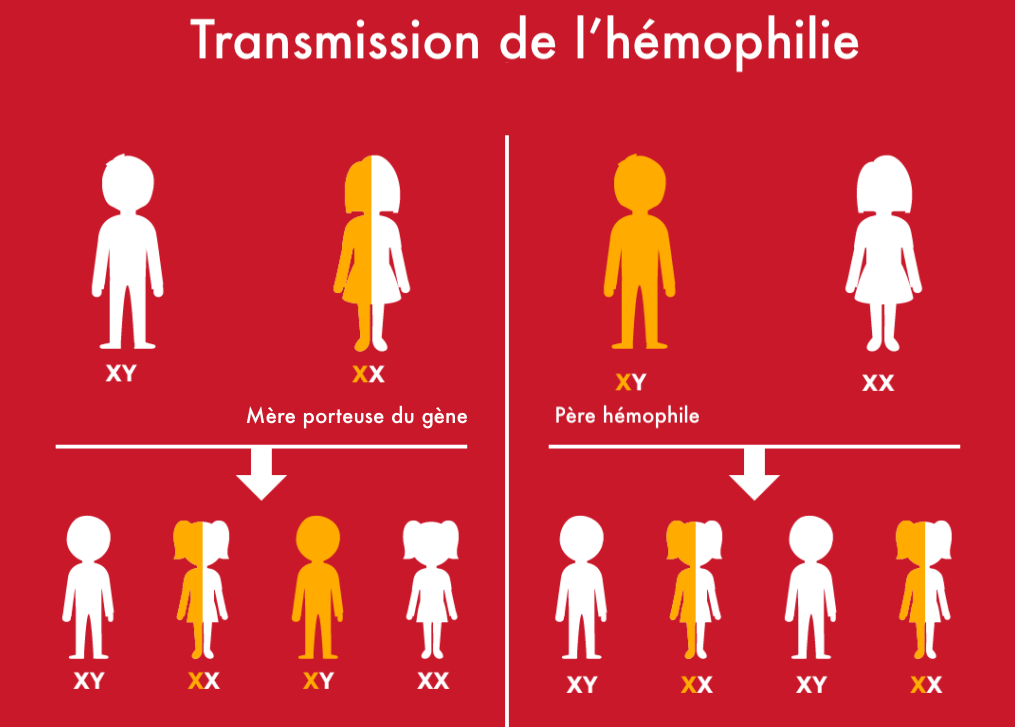 L'hémophilie : Une Maladie Rare Héréditaire